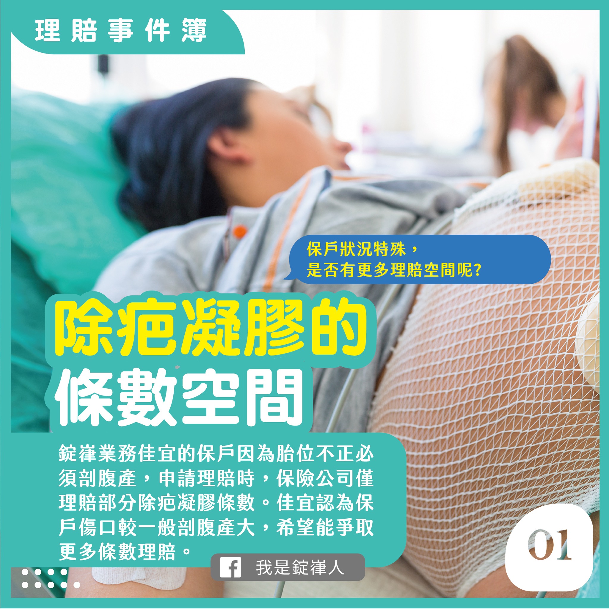 除疤凝膠的條數空間 除疤凝膠的條數空間