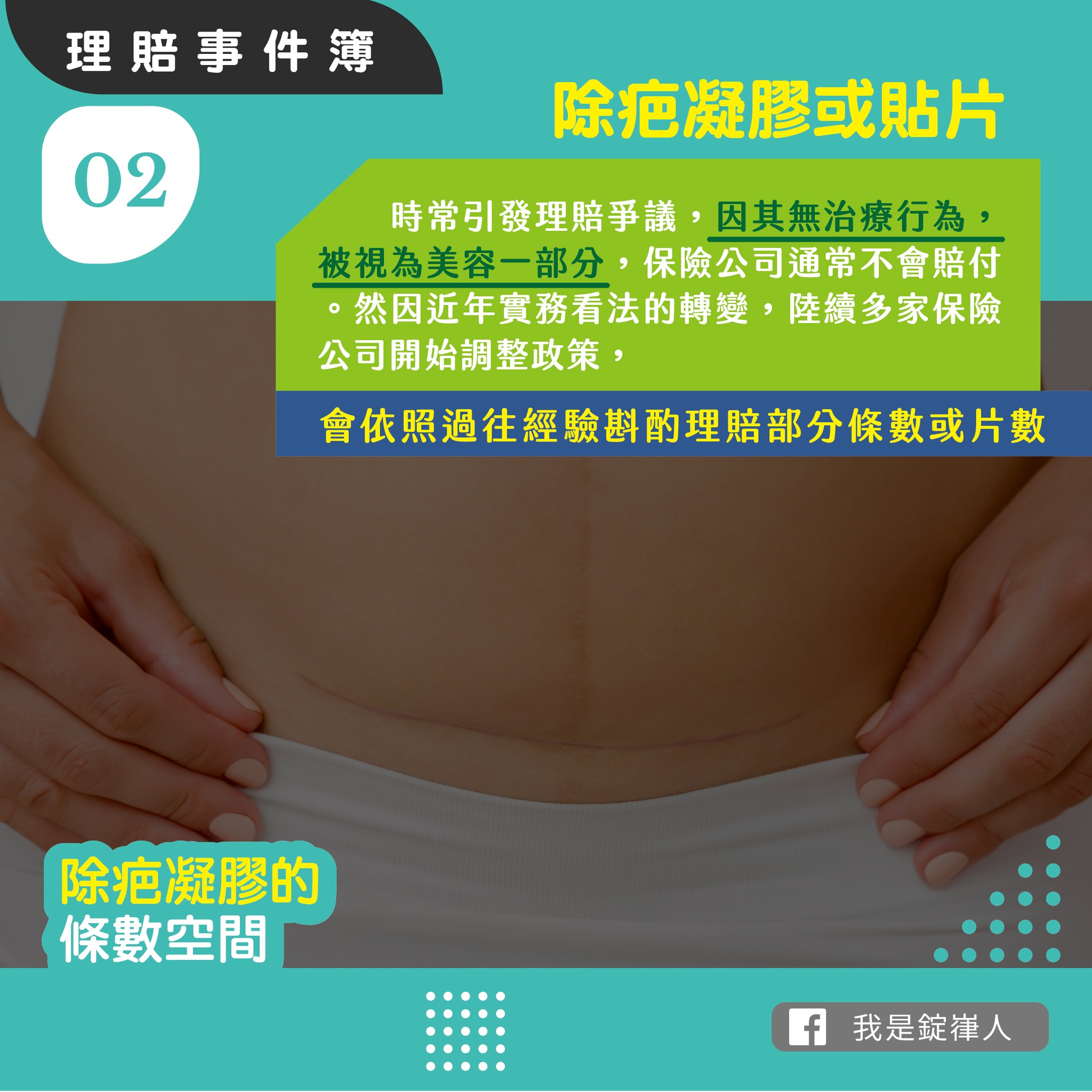 除疤凝膠的條數空間 除疤凝膠的條數空間