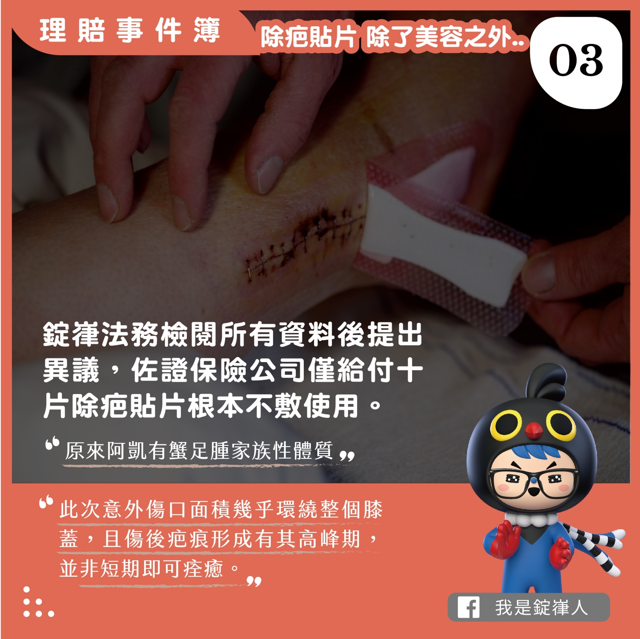 除疤貼片除了美容之外 除疤貼片除了美容之外