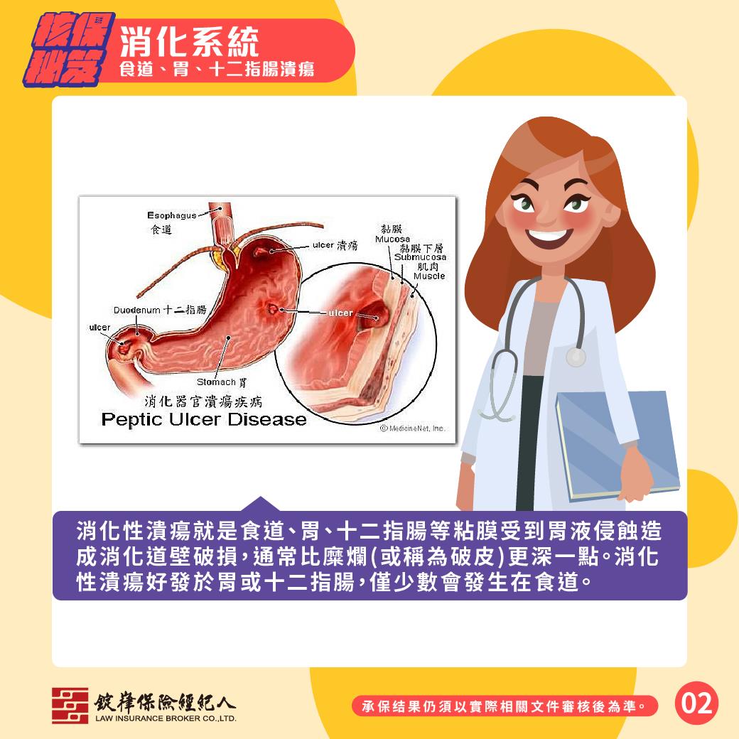 消化系統-食道/胃/十二指腸潰瘍 消化系統-食道/胃/十二指腸潰瘍