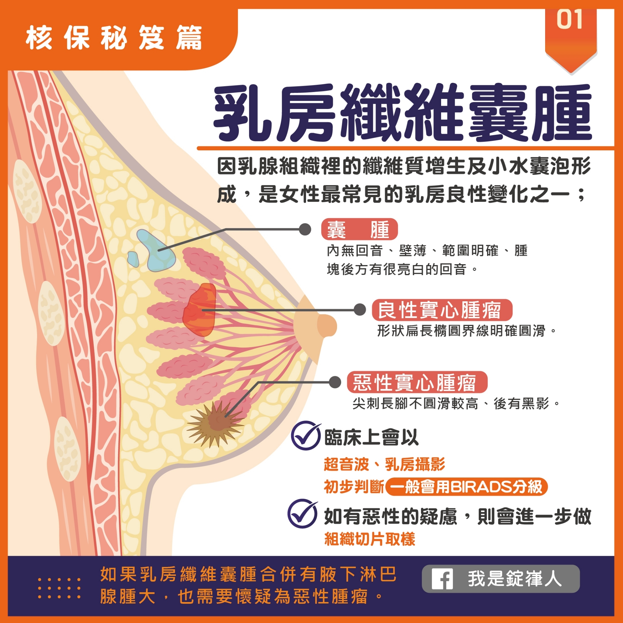 核保秘笈▸乳房纖維囊腫 核保秘笈▸乳房纖維囊腫